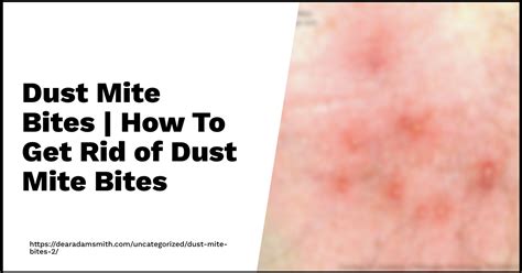 Dust Mite Bites How To Get Rid Of Dust Mite Bites Pictures Dear Adam Smith