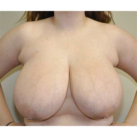 pre breast reduction tits 2 94 pics xhamster