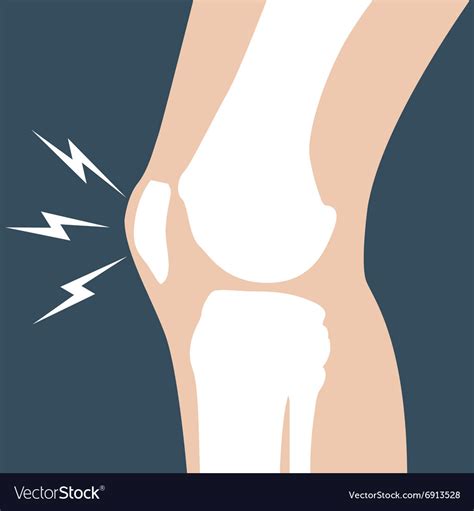 Knee Pain Joint Bones Orthopedic Royalty Free Vector Image