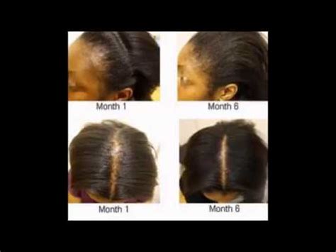 Using castor oil to encourage hair growth is a different method then applying onion juice. ONIONS CAN STIMULATE HAIR GROWTH PROVEN FACT YouTube 360p ...