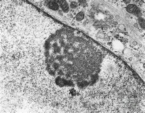 Nucleolus Human Fibroblast Tem Photograph By David M Phillips