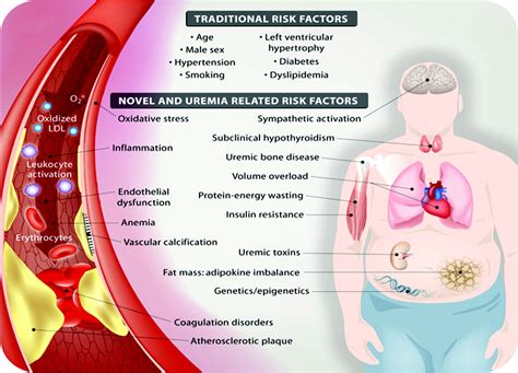 Chronic kidney disease may not become apparent until your. Emerging Biomarkers for Evaluating Cardiovascular Risk in ...