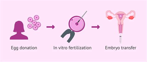 What Is Egg Sharing In Ivf Process Step By Step