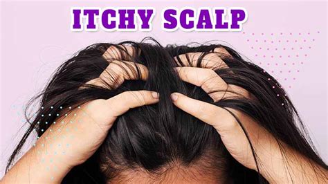 Why Is My Scalp So Itchy And How To Treat It Laylahair