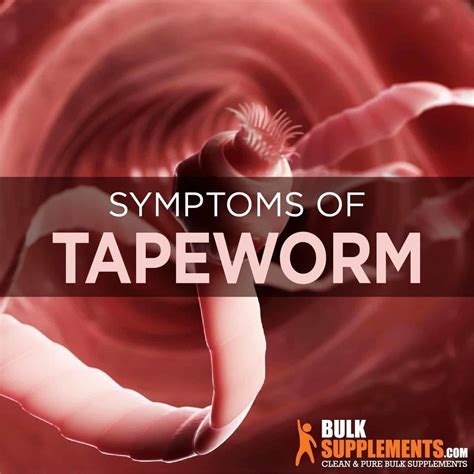 Tablo Read Taeniasis Tapeworm Causes Symptoms And Treatment By