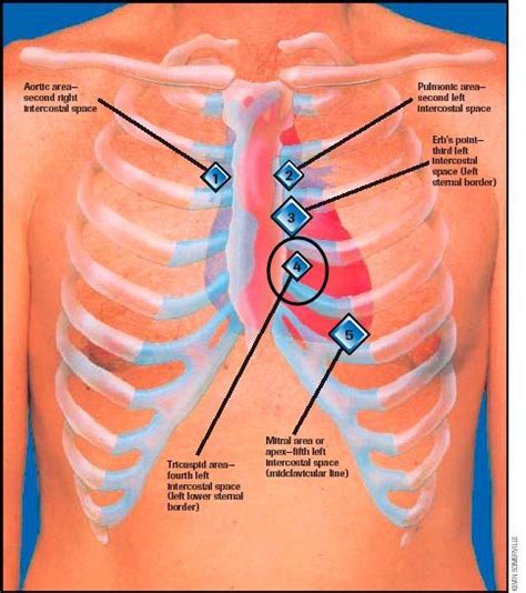 guide to heart murmurs tricuspid regurgitation murmur stepwards