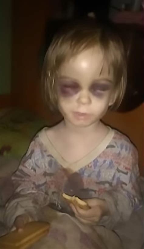Starving And Beaten Russian Girl 3 Rescued After Worried Neighbour
