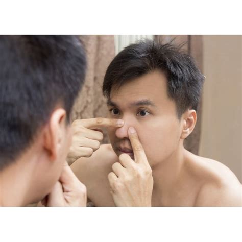 This acne is considered painful and may also form bumps on your nose which is also a result of an inflamed cyst. How to Get Rid of Acne on My Nose | Our Everyday Life