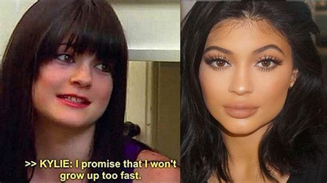 Kylie Jenner Before And After Her Jaw Dropping Transformation Pics