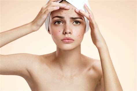 Four Common Skin Concerns And How To Treat Them