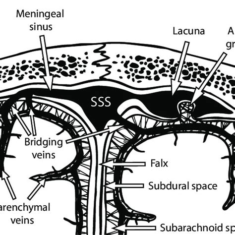 The Superior Sagittal Sinus Sss And Its Relation To Venous Lacunae