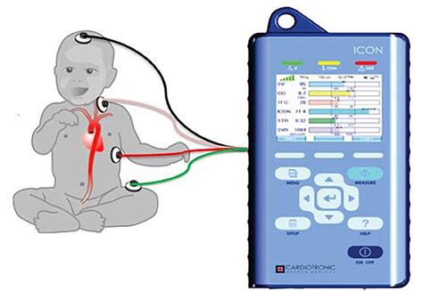 Figure 1 From Non Invasive Cardiac Output Monitoring And Assessment Of
