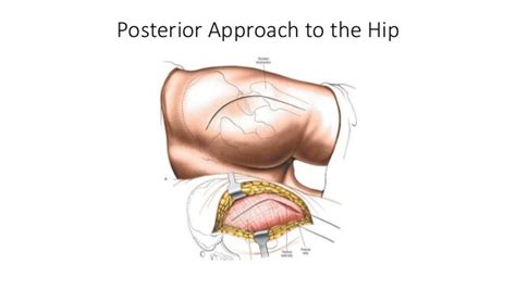 Hip Anatomy Posterior Anatomy Drawing Diagram