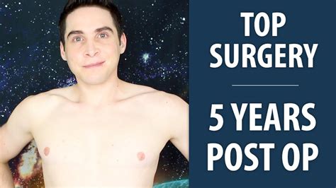 5 years post op dr garramone nonbinary top surgery youtube