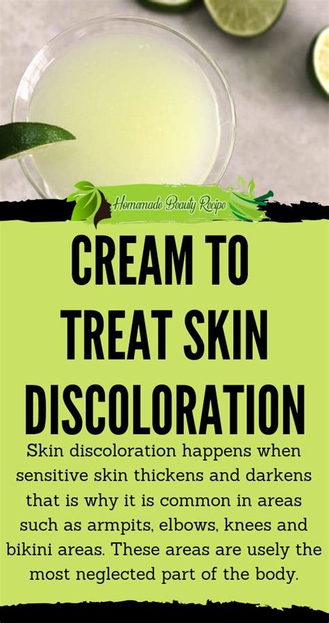 Cream To Treat Skin Discoloration Skin Discoloration Treat Skin Skin