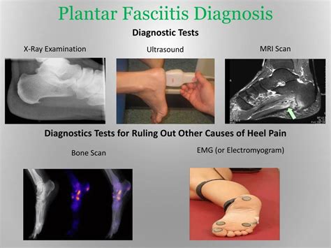 Ppt Plantar Fasciitis And Itâ€™s Treatment Powerpoint Presentation Id8011631