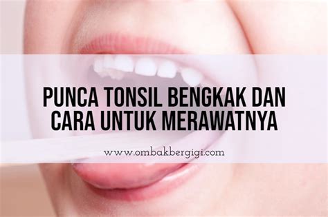 Punca Tonsil Bengkak Dan Cara Untuk Merawatnya