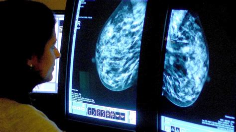 How To Spot The Possible Signs Of Breast Cancer Itv News