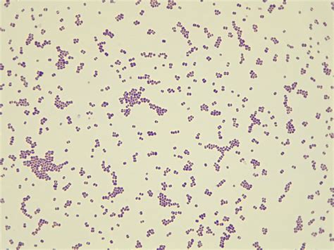 Micrograph Coccus Gram Stain X P Oer Commons