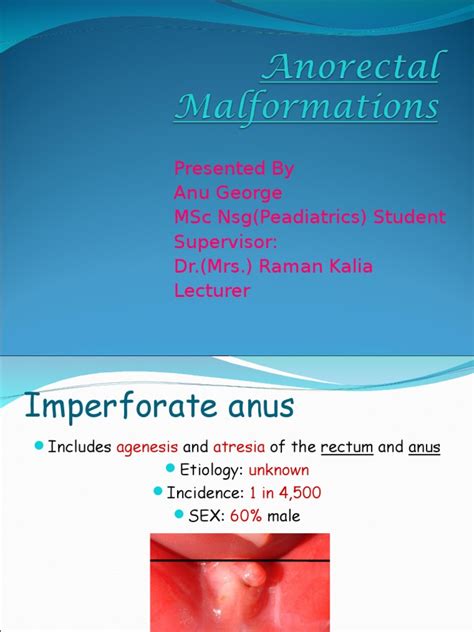 Anorectal Malformationppt Pelvis Diseases And Disorders