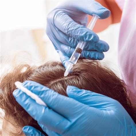 Prp treatments can enhance hair restoration and other cosmetic plastic surgery procedures. PRP Treatment For Hair loss | Side Effect, Success Rate ...