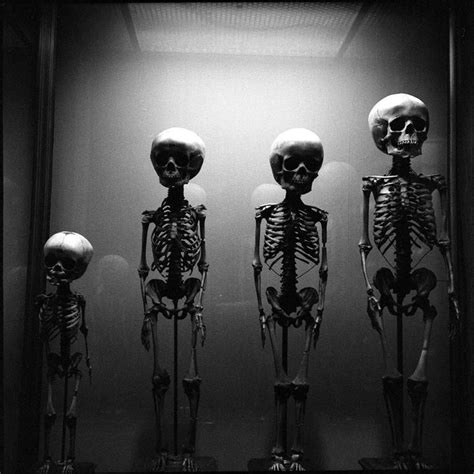 Jgmundie Children Skeletons Child Skeleton Health Fitness Pictures