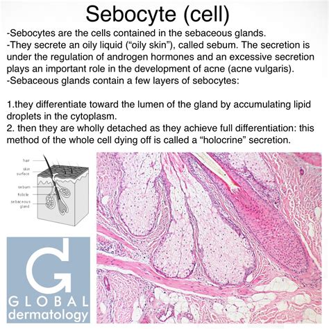 Global Dermatology Sebocyte Instagram