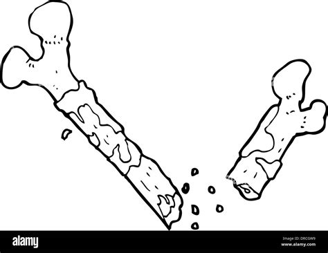 Gross Broken Bone Cartoon Stock Vector Image And Art Alamy
