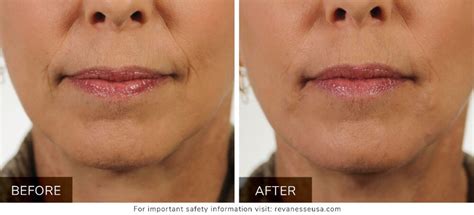 Before and after rainforest was destroyed. Versa - K2 Restorative Medicine & Med-Spa Dr. Pamela Kulback