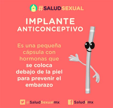 Salud Sexual 10 Datos Que Necesitas Saber Sobre El Implante Anticonceptivo