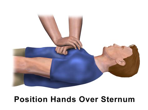 Basic Life Support Bls Osce Guide Cpr Technique Geeky Medics