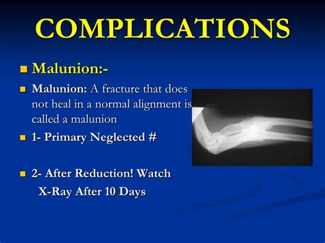 Ppt Musculoskeletal Block Pathology Lecture 1 Fracture And Bone