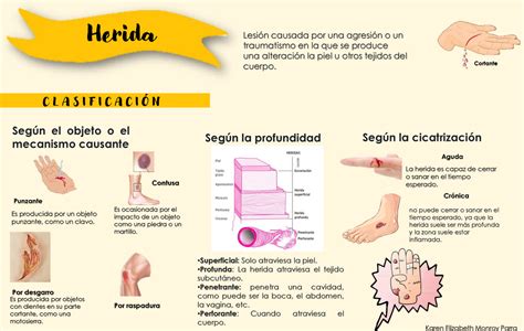 Infografía Sobre Los Distintos Tipos De Heridas Herida Lesión Causada
