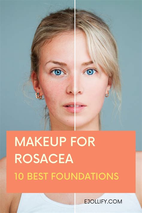 Makeup For Rosacea 10 Best Foundations For Rosacea In 2020 Artofit