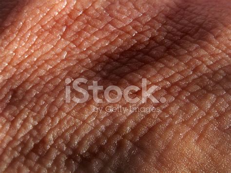Cracked Skin Texture Stock Photo Royalty Free Freeimages