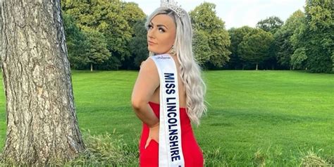 Missnews Miss Lincolnshire Hoping To Become First Miss Great Britain Winner With Alopecia