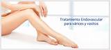 Doctor Para Varices Images