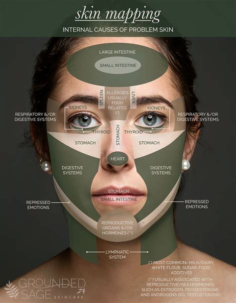 Skin Mapping Acne Face Mapping Acne Break Outs Pimple Face Mapping