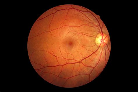 Retina At Piedmont Eye Center