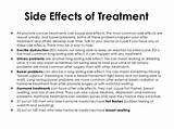 Side Effects Of E Ternal Beam Radiation For Prostate Cancer