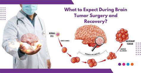 What To Expect During Brain Tumor Surgery And Recovery