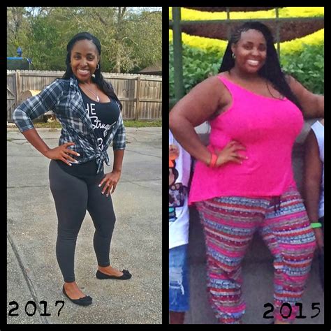 Weight Loss Success Story Teresa Loses An Amazing 140 Pounds After
