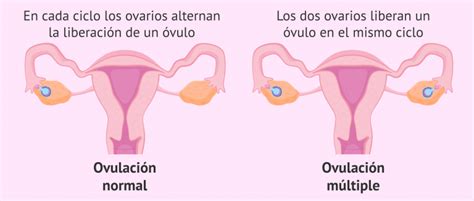 ¿qué Es La Ovulación Múltiple Y Cuáles Son Sus Causas