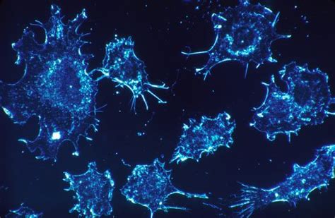 Finding Hidden Cancer Cells New Study Mobilizes The Immune System To