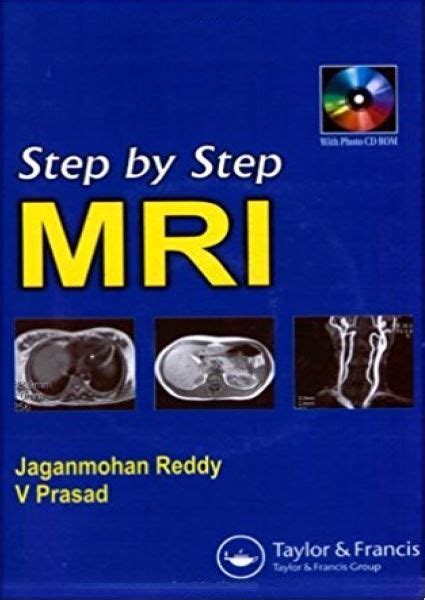 Examples of changes of the pulse : Mri textbook pdf > rumahhijabaqila.com