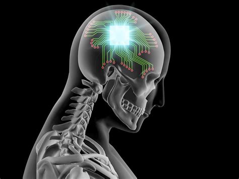 Brain Implant Will Connect A Million Neurons With Superfast Bandwidth