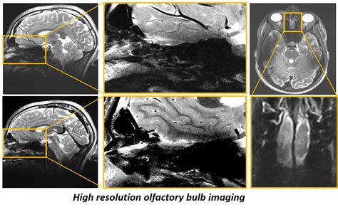 High Resolution Anatomical Imaging Schmidt Mri Lab