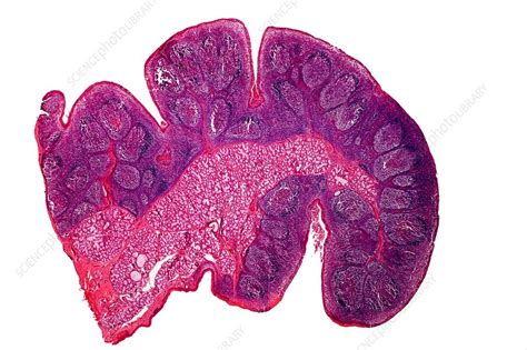 Tonsil Tissue Light Micrograph Stock Image C0118387 Science