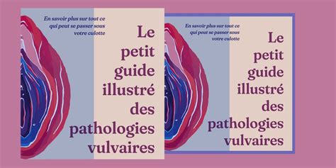 Lire Ce Guide Illustr Vous Dit Tout Sur Les Pathologies Vulvaires Marie Claire