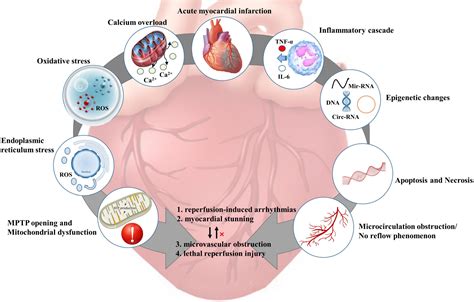 Frontiers Preclinical Multi Target Strategies For Myocardial Ischemia